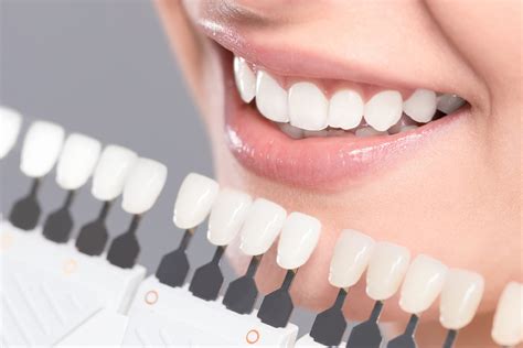 are fake teeth better than real teeth